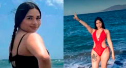 murió tras liposucción 