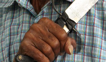 El 50 por ciento de la mano de la mujer quedó afectada.