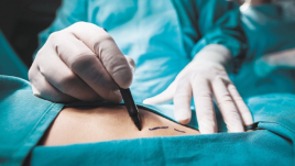 Más de 40 mujeres contrajeron una infección durante cirugía estética en Medellín. 