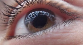 El glaucoma es una enfermedad silenciosa. / Foto: Cortesía