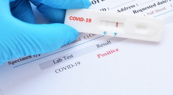 Casos activos de COVID-19 en el país ascienden a más de 100.000./FOTO: Tomada de internet