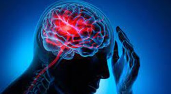 El Accidente Cerebrovascular (ACV) es la segunda causa principal de muerte y una de las principales causas de discapacidad en todo el mundo. 