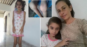 Alexamar Rodríguez Freitez, de 10 años, quien desde los 4 padece artritis idiopática juvenil. / Foto: Cortesúa