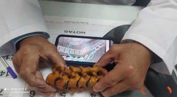 Imagen sobre cómo se lesionó Egan Bernal la columna, tras el choque contra el autobús.