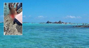 Ataque de tiburón en San Andrés.
