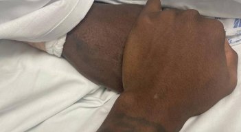 Estado de salud de Freddy Rincón