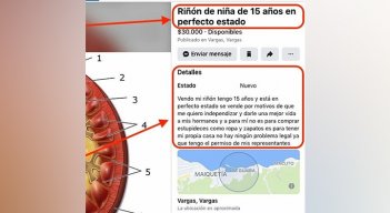 Venta de organos en Venezuela