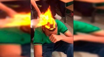 Se incendió el cabello en colegio.