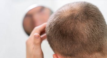 Aprueban píldoras para la caída del cabello. 