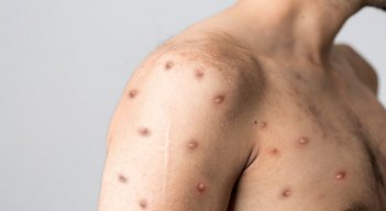 21 días es el tiempo recomendable de aislamiento. / Foto: Cortesía 