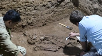 La primera amputación quirúrgica remonta a 31.000 años,