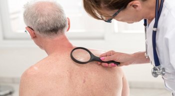 Melanomas. / Foto: Cortesía