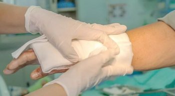 En Norte de Santander, para el periodo 2022-2023, 72 personas resultaron quemadas con pólvora, resaltando que los primeros lesionados se reportaron el 8 de diciembre de 2022./ Foto Cortesía / La Opinión 