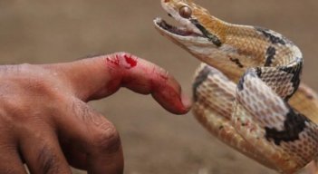Mordedura de serpientes. / Foto: Cortesía / La Opinión 