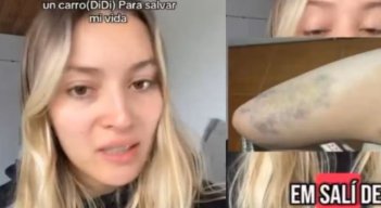 Mujer atacada en un servicio de Didi