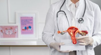 Cáncer de ovario. 