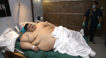 el más obeso del mundo
