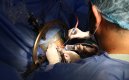 Cirugía exitosa a paciente con Parkinson en Coneuro